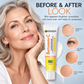 Vitamin C-serum med djupverkande absorption